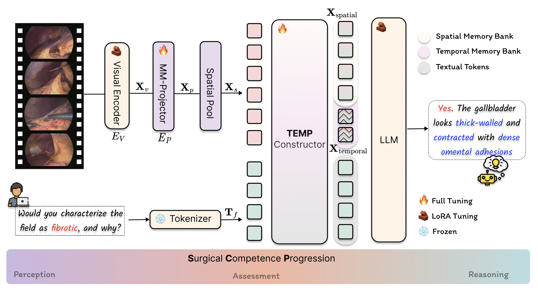 SurgTEMP: Temporal-Aware Surgical Video Question Answering with Text-guided Visual Memory for Laparoscopic Cholecystectomy